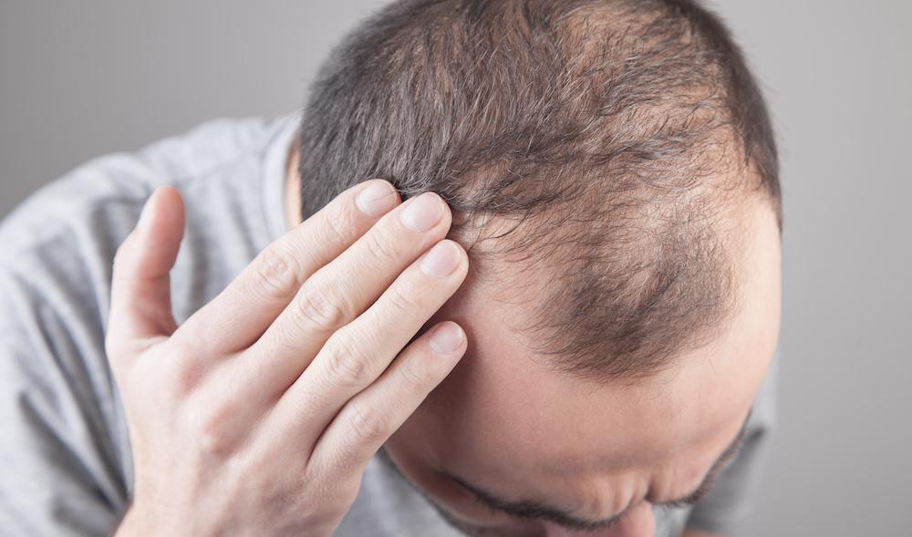 Hair Restoration Med Spa Washington DC