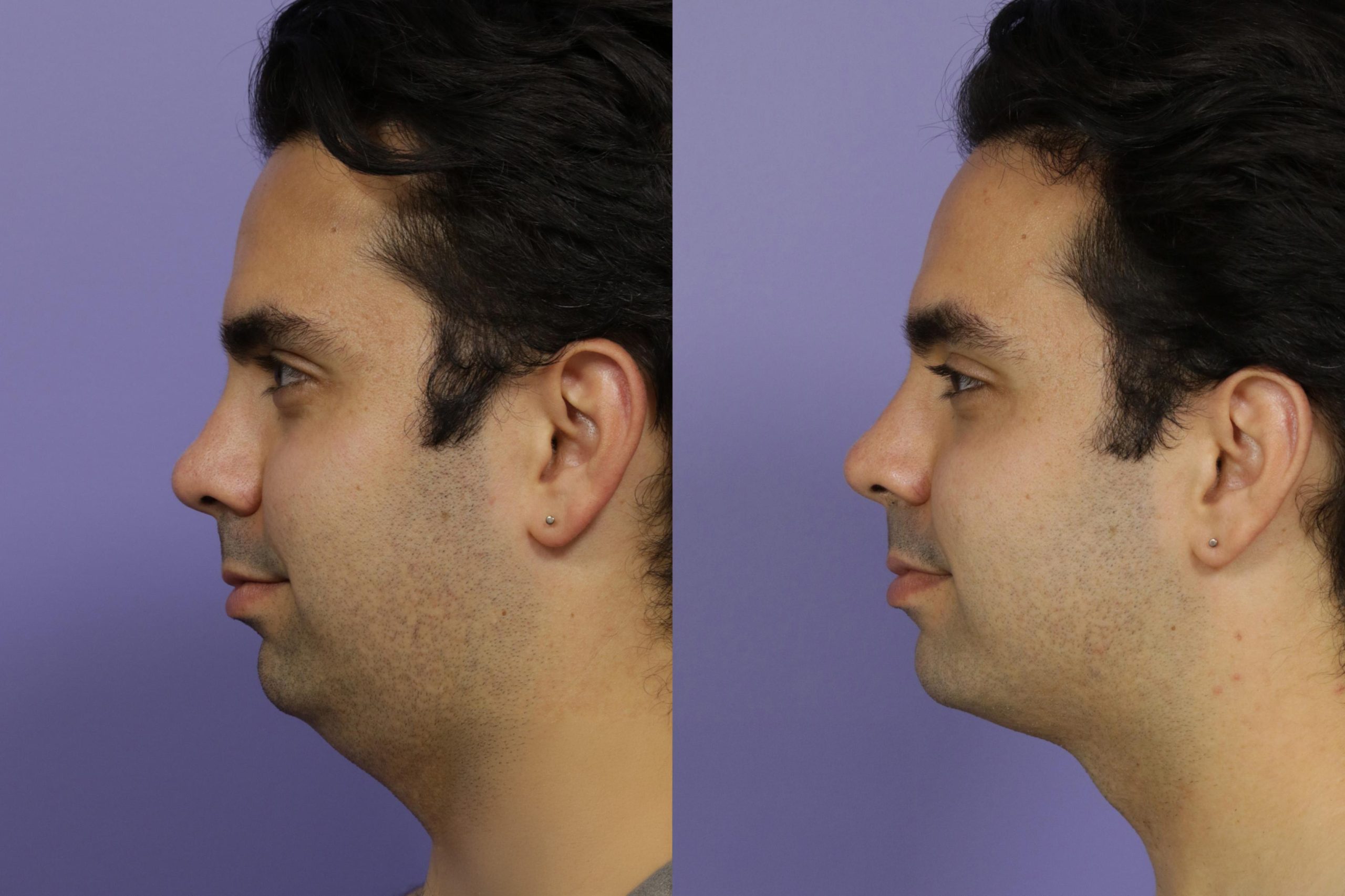 Mens Wellness Health Washington double chin 2