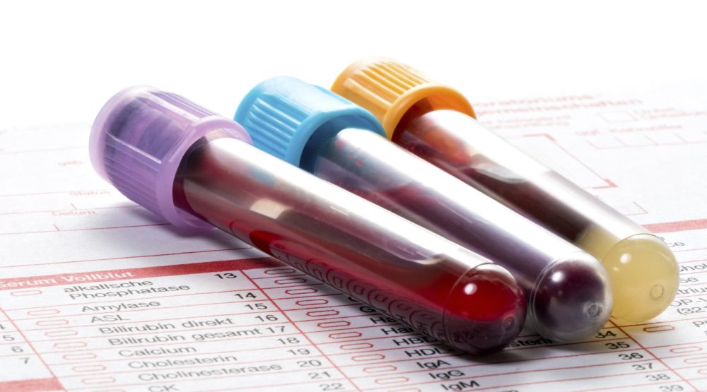 Blood Work Med Spa Washington DC