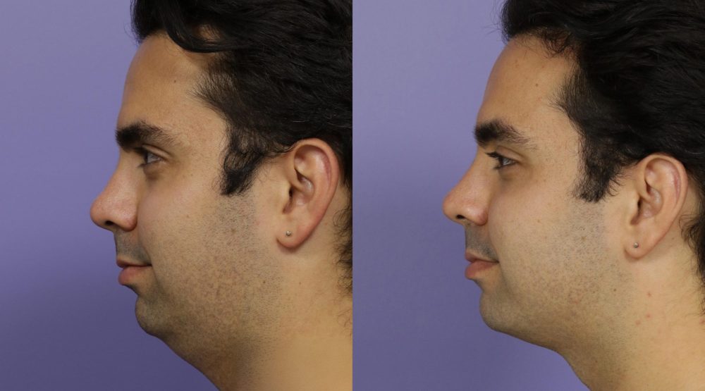 Mens Wellness Health Washington double chin 2